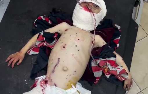 Thumbnail preview image for the video titled: Last breaths of infant Aser killed by Israeli bombing of his family home