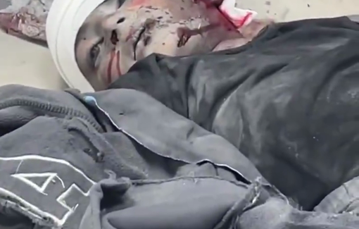 Thumbnail preview image for the video titled: Child killed in Israeli bombing of an apartment in Hamad City