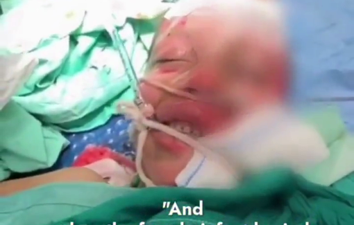 Thumbnail preview image for the video titled: Pediatric surgeon pained by the critical condition of 6 year-old Mariam