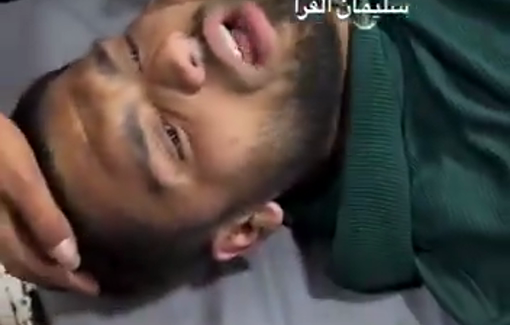 Thumbnail preview image for the video titled: Journalist Abdallah Alattar wounded in direct Israeli airstrike