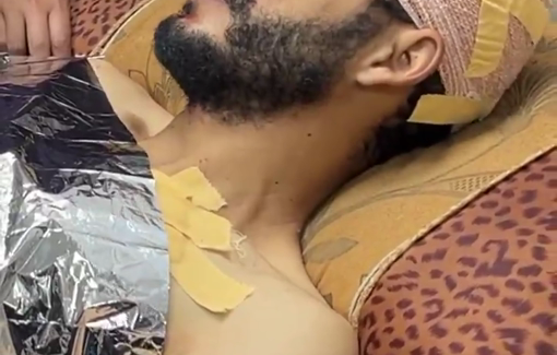 Thumbnail preview image for the video titled: Journalist Hassan Eslayeh wounded in Israeli assassination attempt at Nasser hospital