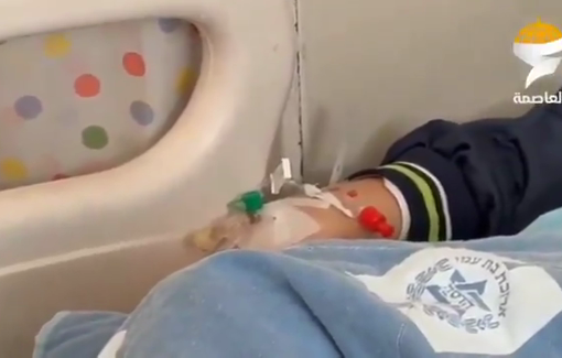 Thumbnail preview image for the video titled: Jerusalemite child Amir Al-Haddad is in the hospital after the Israeli forces fired a rubber bullet at him