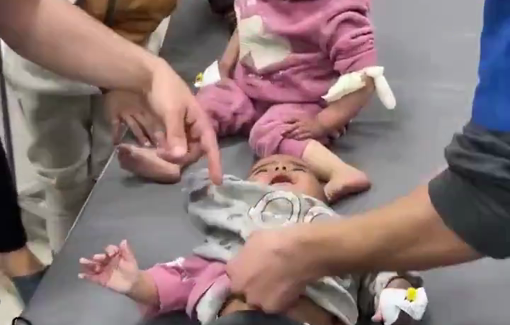 Thumbnail preview image for the video titled: Infants injured in Israeli bombing of the Abu Sahloul family