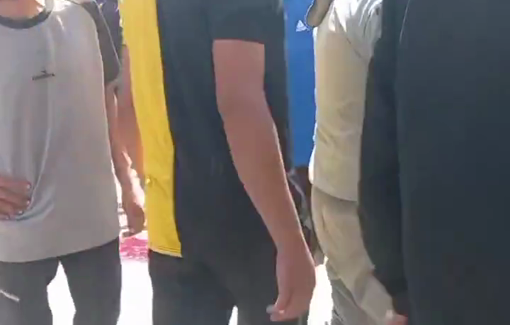 Thumbnail preview image for the video titled: Donkey bleeding profusely after an Israeli massacre at a market killing over 30 people