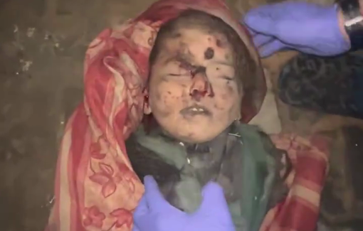 Thumbnail preview image for the video titled: Little girl blown in half in Israeli night bombing of her home