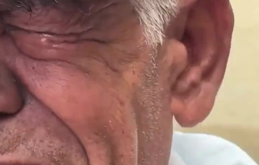 Thumbnail preview image for the video titled: Elderly starved, amputated, and lost all of his children to Israeli bombing