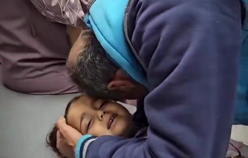 Thumbnail preview image for the video titled: Little girl injured and lost her family in Israeli bombing of tents in Al-Mawasi