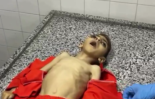 Thumbnail preview image for the video titled: Mustafa Yassin, just 4 years old, has died of malnutrition at Baptist Hospital in Gaza City