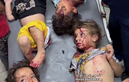 Thumbnail preview image for the video titled: Several children wounded by Israeli night bombing of tents in Al-Mawasi