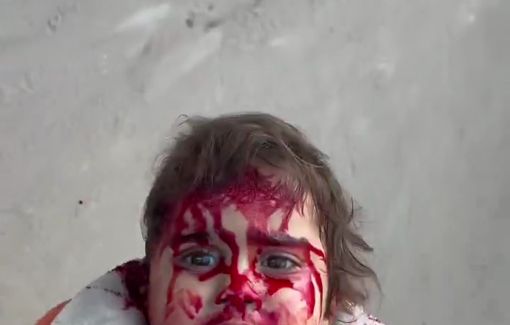 Thumbnail preview image for the video titled: Final moments of a child injured in Israelis trikes on Gaza