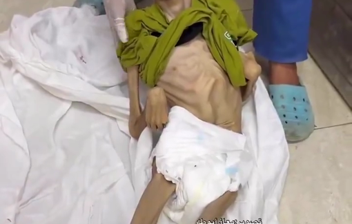 Thumbnail preview image for the video titled: 29 year-old Saber Ayoub Abu Hussein killed by Israel's starvation policy