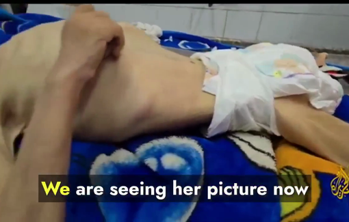 Thumbnail preview image for the video titled: 1.5-year-old Sanaa Al-Lahham has died from severe malnutrition