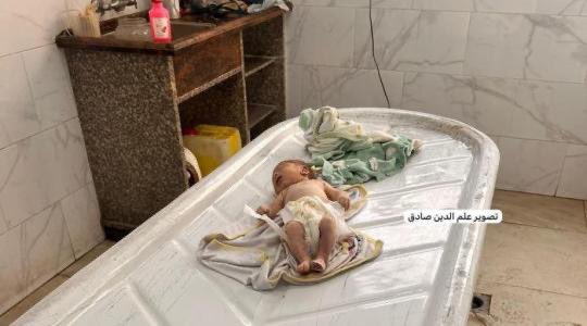 Thumbnail preview image for the video titled: A Palestinian infant from Gaza City, Zain Ahmed Al-Dremeili, has died from hunger and malnutrition