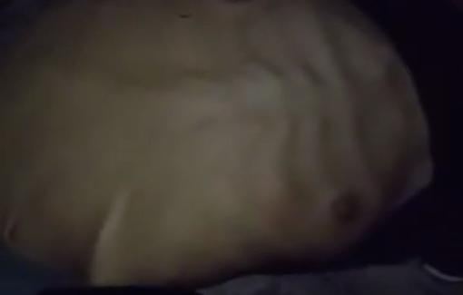 Thumbnail preview image for the video titled: Ahmed, a 17-year-old boy with Duchenne muscular dystrophy, now immobile due to starvation.