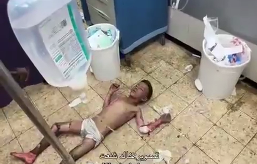 Thumbnail preview image for the video titled: Children with burn injuries following Israeli night strike on Faysal school