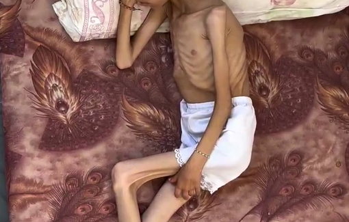 Thumbnail preview image for the video titled: Mariam 9y/o is being starved by Israeli blockade