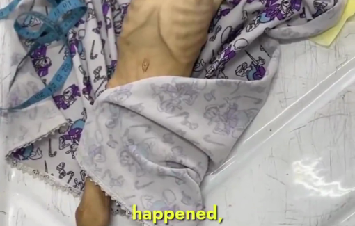 Thumbnail preview image for the video titled: 2 y/o Roa Amin Mashi killed by Israel's starvation policy