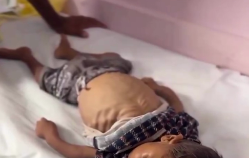 Thumbnail preview image for the video titled: 5 year-old Jamal Al-Najjar starved to death