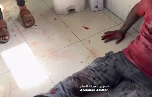 Thumbnail preview image for the video titled: Reuters journalist Hatim Omar wounded in Israeli strike on Nasser hospital