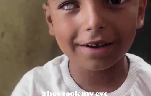 Thumbnail preview image for the video titled: 6 year-old Imran lost his eye to an Israeli drone