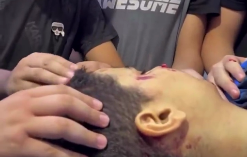 Thumbnail preview image for the video titled: Last farewell to the child Islam Abdel Aziz Majarma (14 y/o) killed by Israeli gunfire in Jenin Camp.