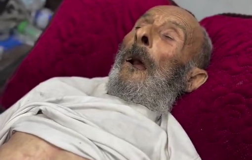 Thumbnail preview image for the video titled: Elderly comatose for a week due to malnutrition