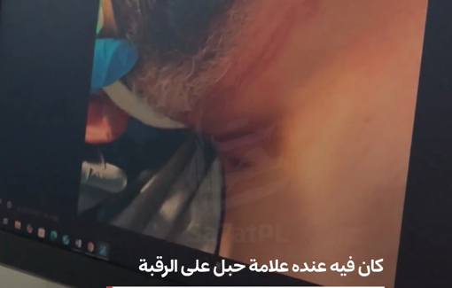 Thumbnail preview image for the video titled: Israeli prison torture leaves elderly Palestinian Mahmoud Al-Wardian comatose