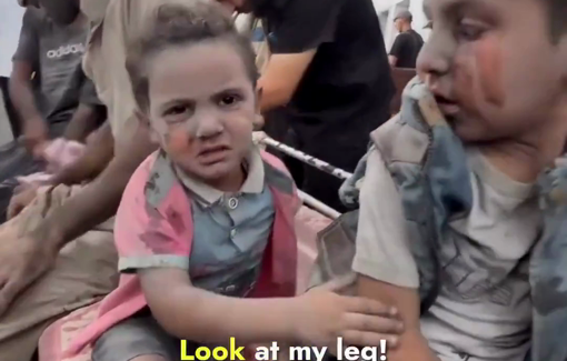 Thumbnail preview image for the video titled: "Where did mom and dad go?" Children injured in Israeli strike on a café shelter