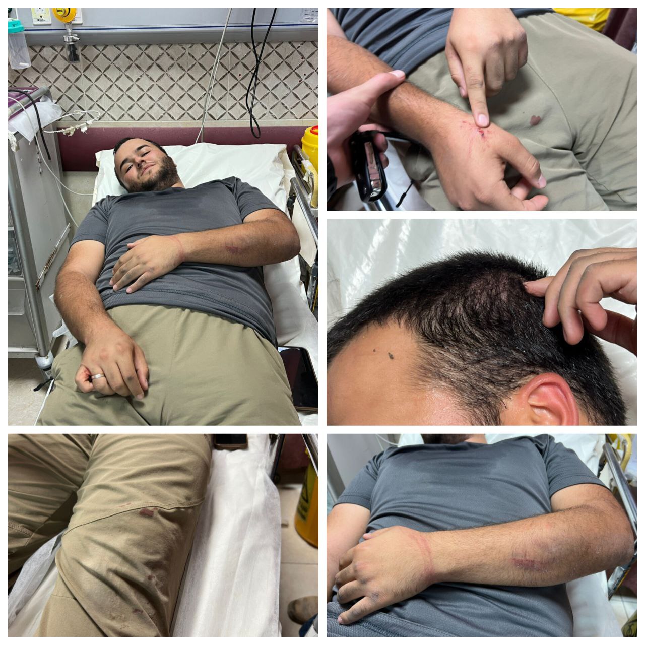 Thumbnail preview image for the video titled: Israeli forces severely beat Quds Network journalist Hamza Hamdan after detaining him while he covered olive harvesting in the Ramin Plain