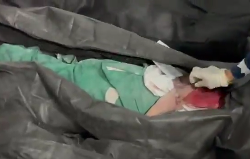 Thumbnail preview image for the video titled: The US airstikes on the elementary school in Minab massacred more than 108 little students