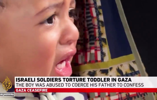 Thumbnail preview image for the video titled: Cigarettes were extinguished on the body of a Palestinian baby to extract information about his father.