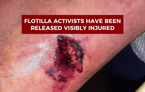 Thumbnail preview image for the video titled: All of the members of the Global Sumud Flotilla abducted by Israel were violently tortured, and some were sexually abused