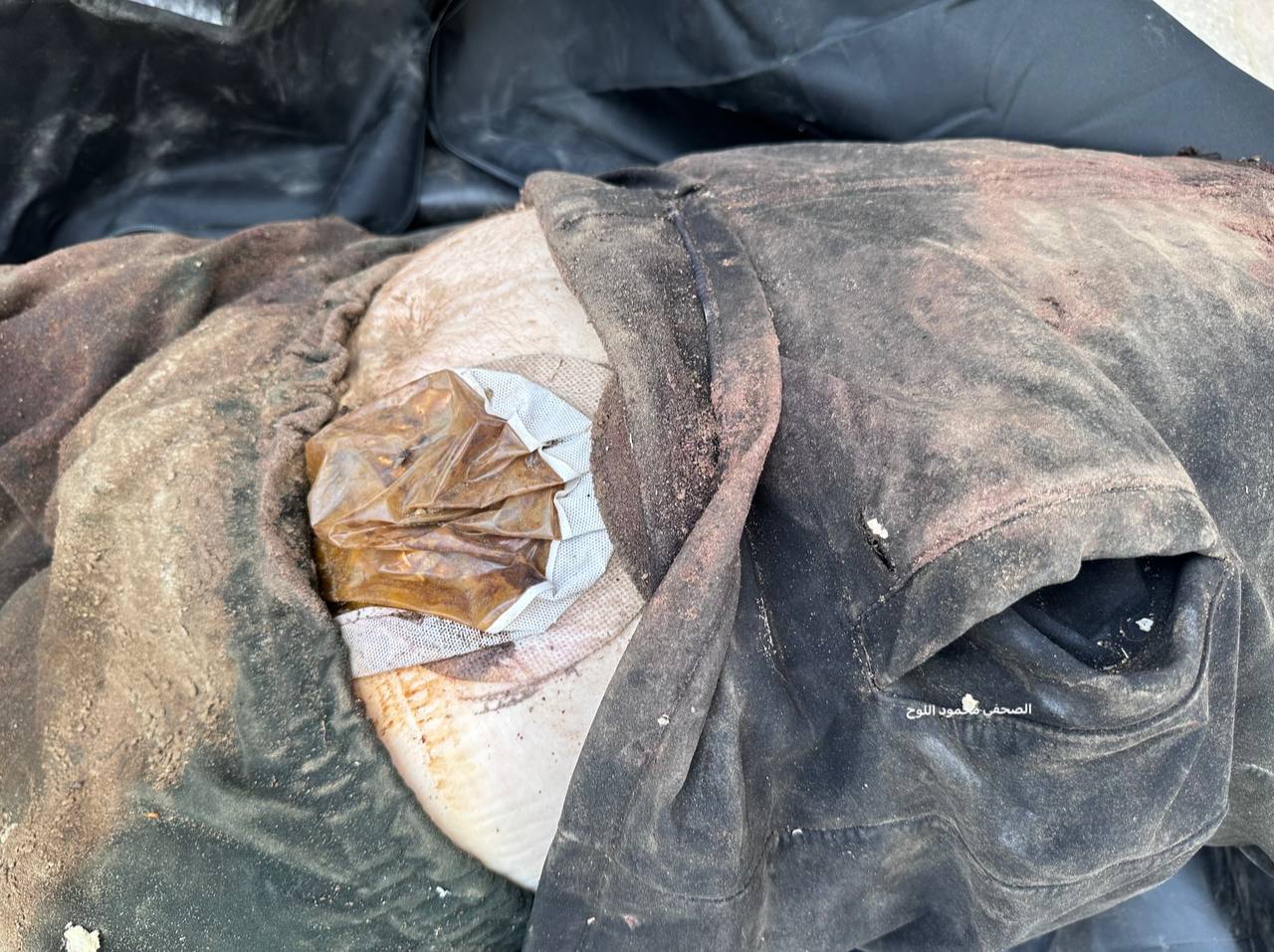 Thumbnail preview image for the video titled: Israeli forces returned the body of an elderly Palestinian detainee with an amputated leg
