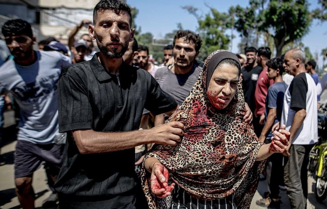 Thumbnail preview image for the video titled: Woman injured in Israel's massacre of police leadership near Gaza City Park