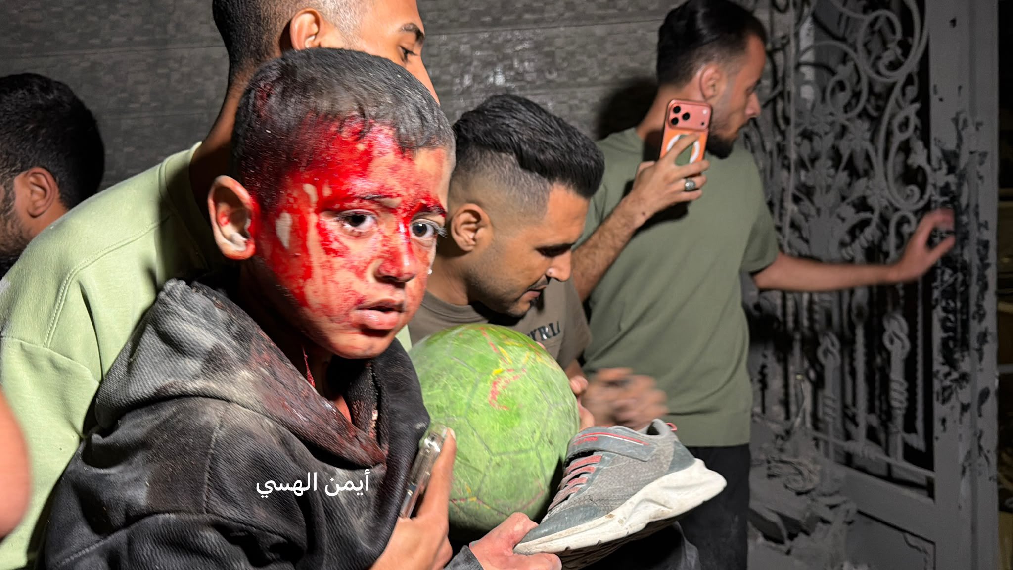 Thumbnail preview image for the video titled: Rescued wounded child clings to his ball and shoe