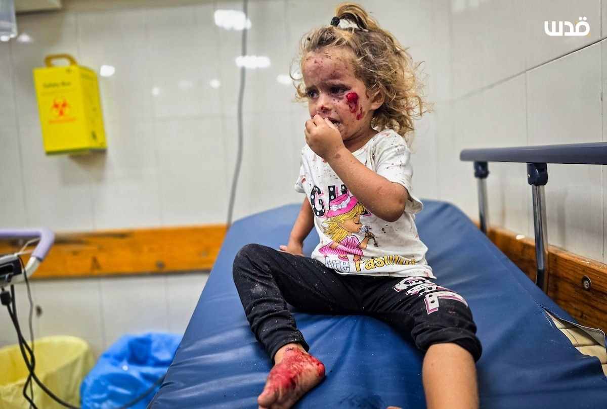 Thumbnail preview image for the video titled: Children injured in Israeli drone strike in Al-Mawasi
