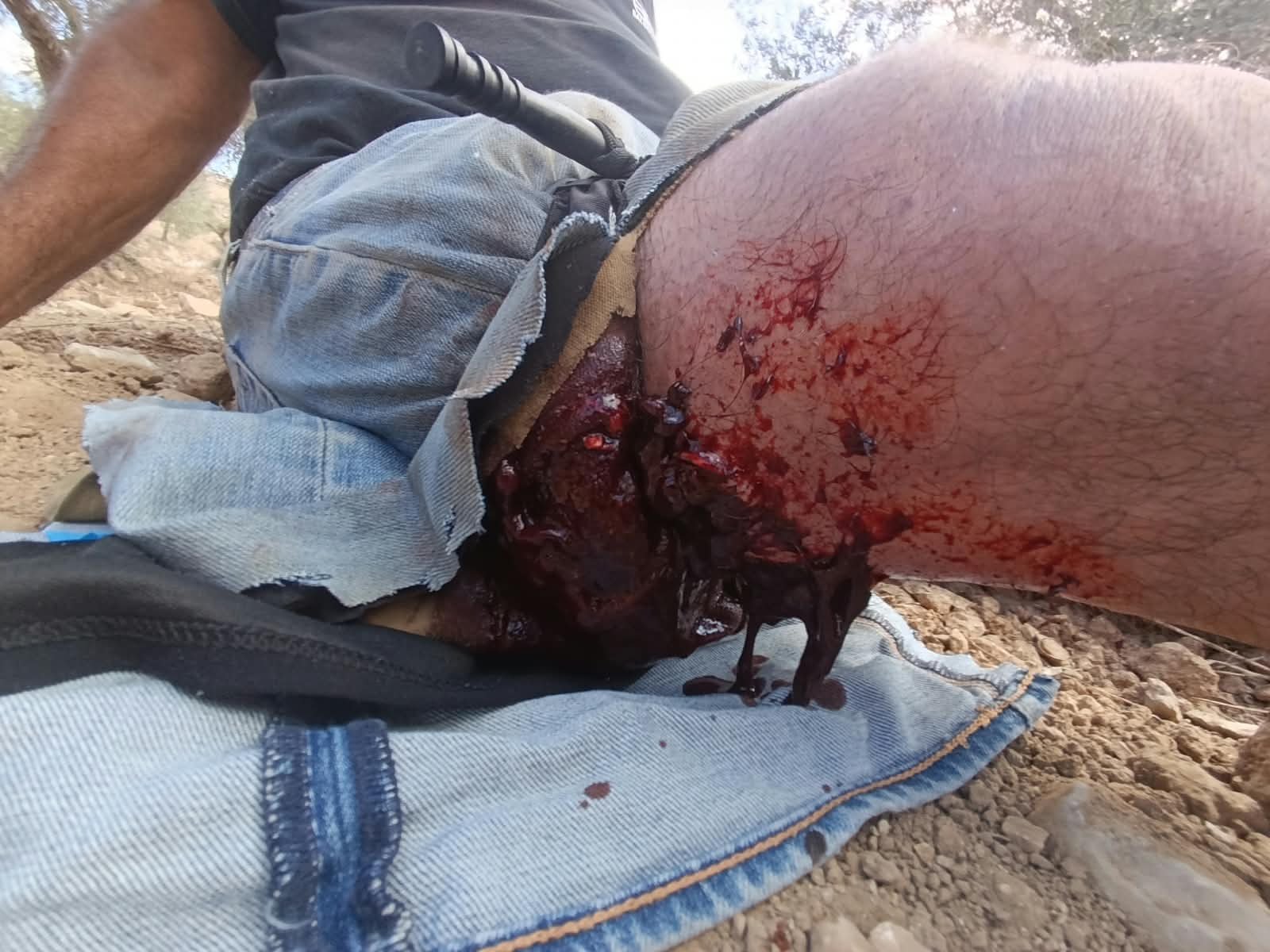 Thumbnail preview image for the video titled: 9 wounded, 4 seriously, one murdered in a settler attack against the olive harvesters in Ramin