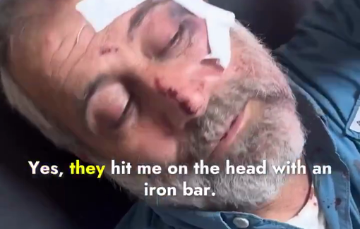 Thumbnail preview image for the video titled: In Ramin : "My cousin was martyred, and they hit me on the head with an iron bar"