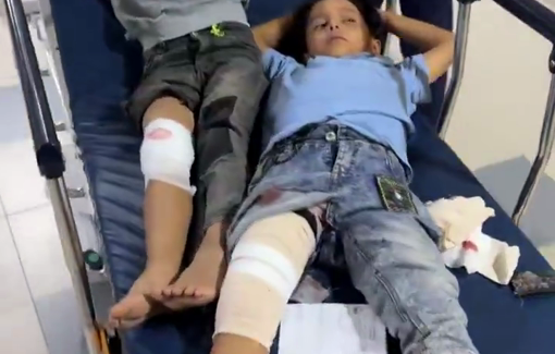Thumbnail preview image for the video titled: Siblings Wasim and Amir Shorrab among 3 children injured by Israeli gunfire in Khan Younis
