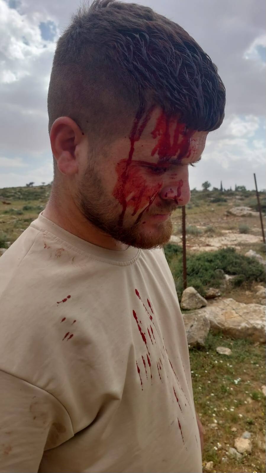 Thumbnail preview image for the video titled: Pogrom in Khirbet Lasefer by the settlers Yedidya and Betzalel Talia, backed by Israeli forces and he settler Shem Tov Luski, from the Old Susya outpost